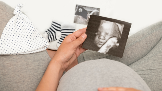 Nézd meg babádat velünk! - 4D Babamozi a LilyMednél